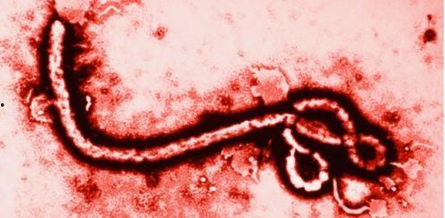 伊波拉病毒DVD在线观看,生死边缘的惊悚纪实